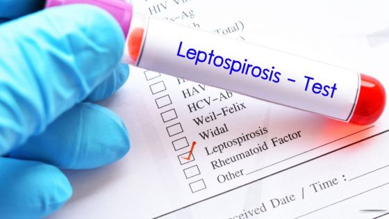 41 cas de leptospirose enregistrés en cinq mois