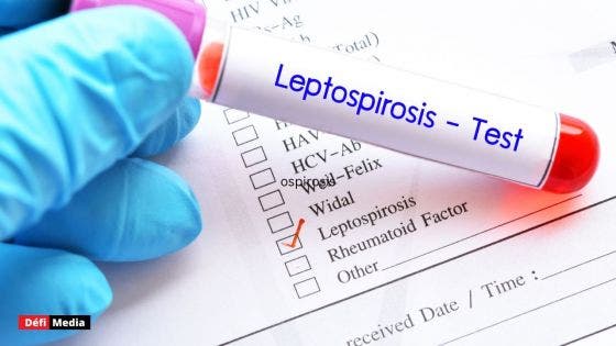 Un plan opérationnel mis en place pour contrer la leptospirose