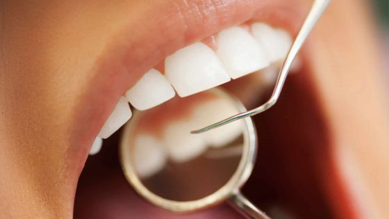 Les pratiques 'bizarres' d’un dentiste dénoncées au Dental Council