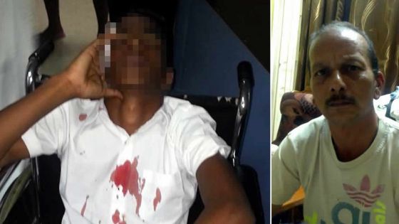 Collégien blessé à Plaine-Verte - L’agresseur: «J’ai sorti la barre de fer pour l’intimider»