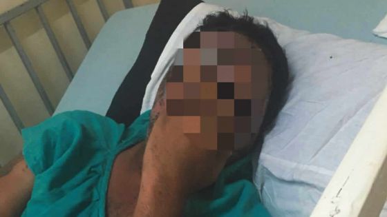 Agression à l’acide à Petit-Raffray: il perd la vue à cause d’une liaison