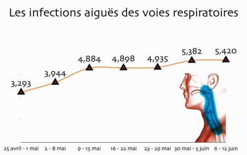Infections aiguës des voies respiratoires: les remèdes de grand-mère à éviter