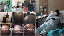 Opération en Inde : atteint de paralysie abdominale, Avinash demande de l’aide