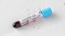 Covid-19 : Deux nouveaux cas de contamination locale confirmés ce samedi soir