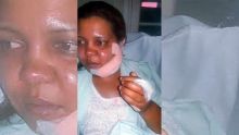 Corine Fra agressée au visage par son mari : «Je dois la vie à ma fille»