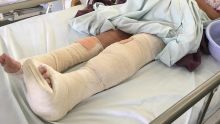 Elle risque une amputation des pieds : à 82 ans Denise est blessée dans un accident