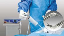 Chirurgie : les avantages de la laparoscopie 