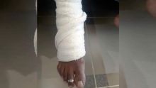 Près d’un centre commercial à Riche-Terre : une gérante de 51 ans attaquée et dépouillée de Rs 80 000