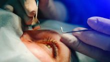 Afin de réduire la liste d’attente : un millier de cas de cataracte traités dans un hôpital privé