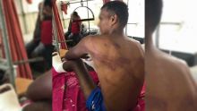 Brutalité policière alléguée : Krishna Seetul réclame Rs 90 millions de dommages