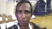 Auteur d’un vol sur un Bangladais : le bras plâtré, un suspect s’enfuit du poste de police de Goodlands