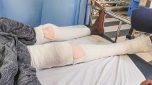 Alors qu’il cueillait des fruits : blessé par balle à la jambe, Dilshad G. risque l’amputation