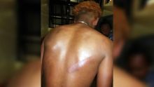Grande-Pointe-aux-Piments : un jeune homme allègue avoir été brutalisé par une équipe de l'Adsu