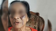 Attaquée en plein sommeil par un intrus : «Monn sap dan lamor», raconte la veuve de 71 ans
