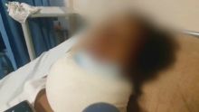 À la suite d’une dispute : un jeune de 22 ans agressé au sabre à La-Tour-Koenig
