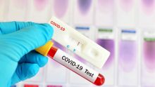 Test antigénique vs PCR : quelle efficacité ?