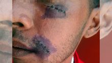 À Roche-Bois : il est agressé le jour de l’anniversaire de sa fille