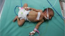 Trente-neuf bébés en danger de mort à l'hôpital de Gaza en raison du manque d'oxygène 