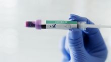 Employée vaccinée testée positive à la Covid-19 : les locaux d’Innodis à Phoenix fermés jusqu’à mardi 