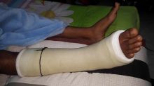 Caudan : un étudiant blessé et alité après un saut de 12 mètres