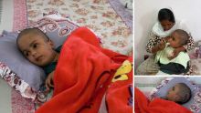 Appel à l'aide : atteint d'une maladie rare, Moozamir, 15 ans, vit comme un bébé