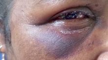 Devi, 56 ans, violemment agressée par un voleur 