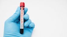 L'Inde rapporte son premier cas de variole du singe