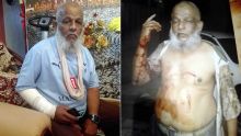 Vol avec violence - Bhai Sadeck, boutiquier : «Ils ont tenté de m’égorger» 