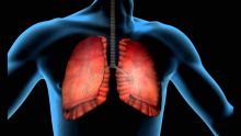 Tuberculose : 47 cas depuis janvier