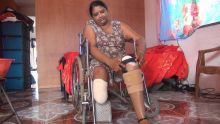Amputée des deux pieds : le combat de Venita Purbhoo pour marcher à nouveau