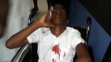 Un collégien battu à coups de barre de fer: un homme interpellé