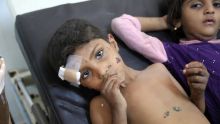 Yémen: des raids aériens saoudiens font au moins 20 morts dans un mariage 