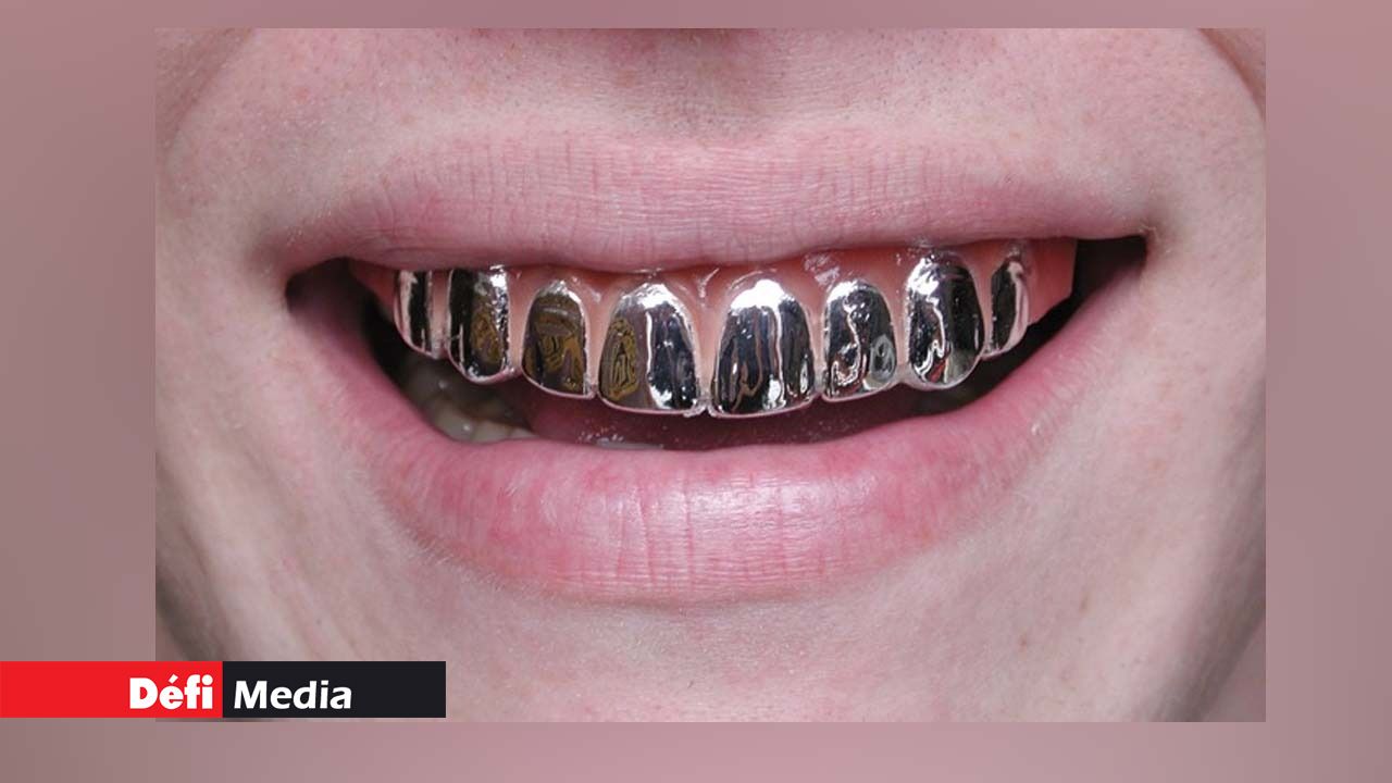 Железный привкус. Металлическая коронка. Вставные металлические зубы. Металлические зубные коронки.