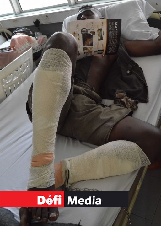 Giovanni S.L. menotté à son lit d’hôpital, a reçu une cinquantaine de projectiles aux jambes.