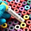 Chikungunya : Mayotte est passée en phase d'épidémie, selon Santé publique France