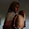 Un enfant sur cinq dans la ville de Gaza souffre de malnutrition, selon une agence de l’ONU 