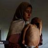 La catastrophe à Gaza rappelle les famines en Ethiopie et au Biafra, selon l'ONU