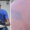Bois d’Oiseaux – Sauvagement agressé, il remet une vidéo accablante à la police, mais attend toujours justice