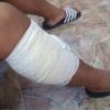 Un collégien de 15 ans agressé au cutter : «Enn garson inn koup mo lipie 3 fwa»