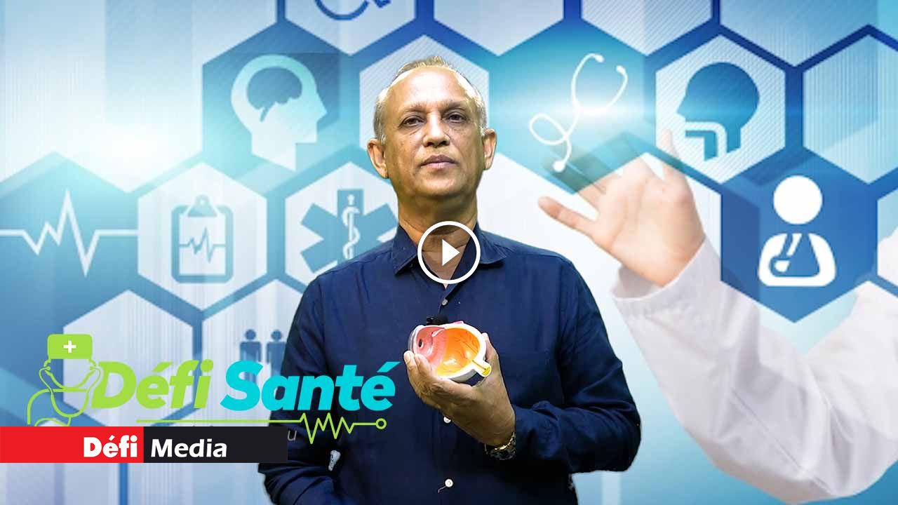 Quelles sont les causes de la cataracte ? | Defimedia Quelles sont les causes de la cataracte ? | Defimedia